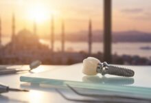 A close-up, detailed photograph of a complete dental implant on a sterile surface inside a modern clinic, with a blurred view of the Istanbul, Turkey skyline through a window in the background.