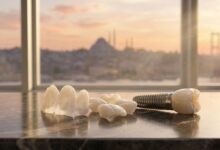 A close-up of perfect porcelain veneers and a dental implant model on a table in a luxury hotel room, with a beautifully blurred, scenic view of the Istanbul, Turkey skyline in the background at sunrise.