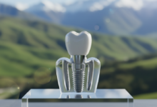 A photorealistic image of a detailed dental implant model showing the titanium post, abutment, and ceramic crown, resting on a clean, light surface. The background is a deeply blurred, soft-focus view of iconic green rolling hills or mountains of New Zealand, conveying the topic of dental implant costs and guidance in the region.