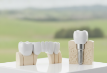 Close-up of two conceptual dental solutions: on the left, three connected white porcelain crowns representing a dental bridge; on the right, a titanium post rooted in bone with a single white porcelain crown representing a dental implant. Both are on a sterile white surface with a blurred New Zealand landscape in the background.