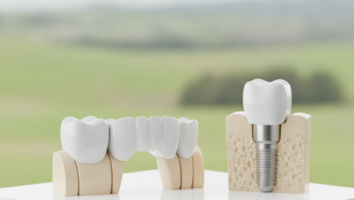 Close-up of two conceptual dental solutions: on the left, three connected white porcelain crowns representing a dental bridge; on the right, a titanium post rooted in bone with a single white porcelain crown representing a dental implant. Both are on a sterile white surface with a blurred New Zealand landscape in the background.