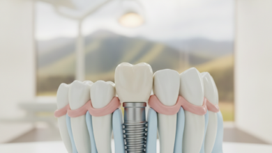 Close-up, ultra-detailed view of a perfectly integrated dental implant with a natural-looking ceramic crown, showing the titanium post fused with a stylized, healthy jawbone and healthy gum tissue. The background is a very softly blurred modern dental clinic, with an extremely indistinct, abstract hint of New Zealand's natural scenery visible through a window. The lighting is clean and bright, emphasizing precision and health.
