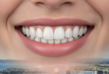 A close-up, photorealistic image of a radiant, healthy smile with bright, perfectly aligned teeth, suggesting successful dental veneer treatment. The background is softly blurred, showing a hint of Wellington, New Zealand's cityscape or harbor under natural light.