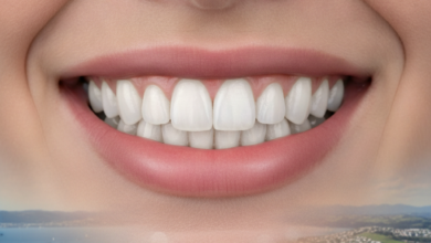 A close-up, photorealistic image of a radiant, healthy smile with bright, perfectly aligned teeth, suggesting successful dental veneer treatment. The background is softly blurred, showing a hint of Wellington, New Zealand's cityscape or harbor under natural light.