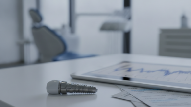 A close-up, photorealistic view of a polished dental implant resting on a modern desk. Beside it are blurred, abstract financial documents with graphs and forms, and a softly out-of-focus clean office or dental clinic in the background. No text is visible.